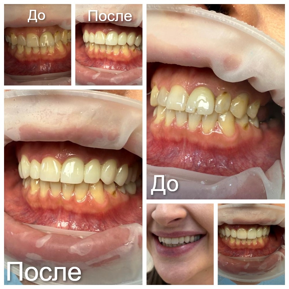 MyCollages (1).jpg